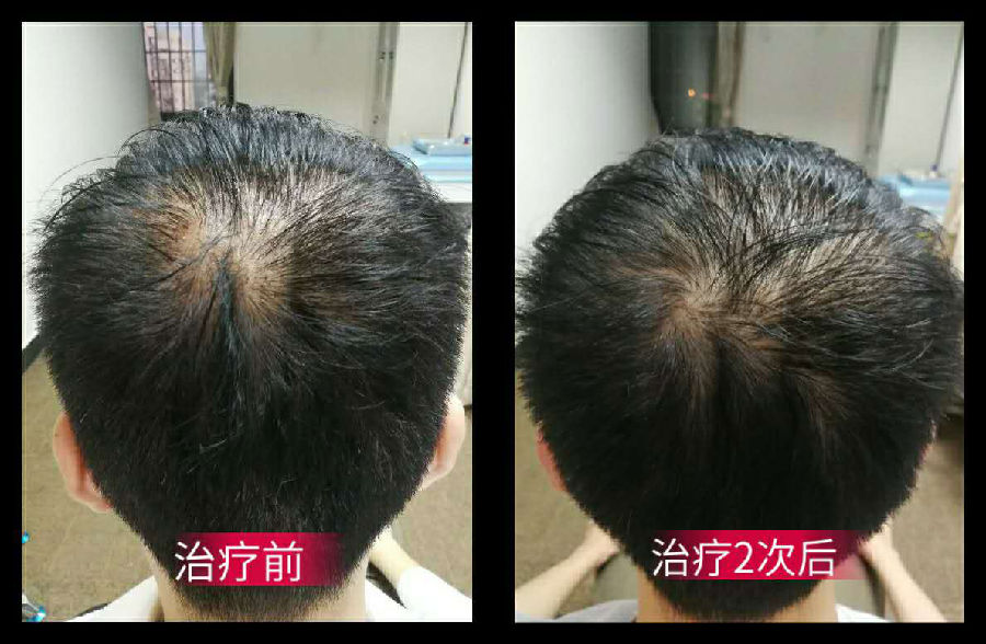 中医生发治疗前后.png