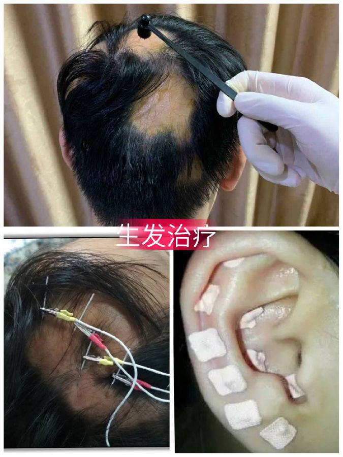 中医生发治疗.png