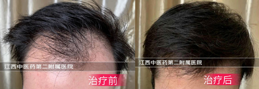 中医生发治疗前后对比.png